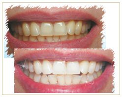 Slider image (5) Bangkok Dental Image